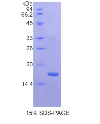 高分子量激肽原(HMWK)重组蛋白