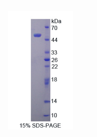 层粘连蛋白γ3(LAMC3)重组蛋白