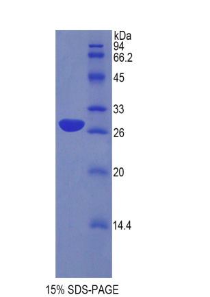 鞘磷脂蛋白0(MPZ)重组蛋白