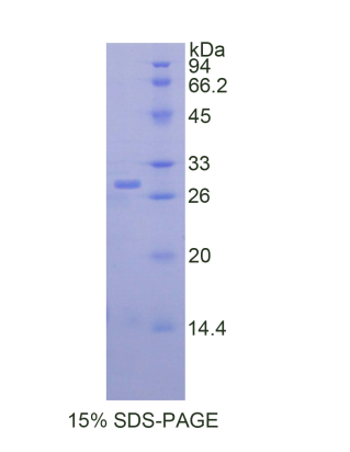 肾肿瘤抗原(RAGE)重组蛋白