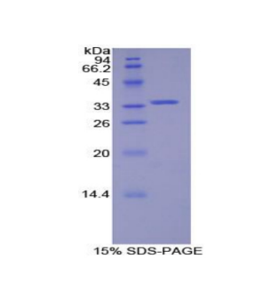 脾脏酪氨酸激酶(SYK)重组蛋白