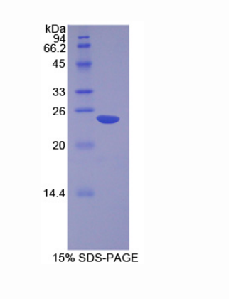 非转移细胞6表达蛋白(NME6)重组蛋白