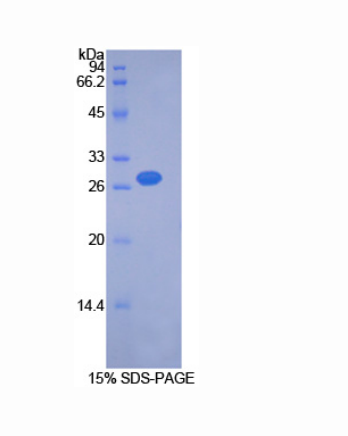 丙酮酸脱氢酶激酶同工酶2(PDK2)重组蛋白
