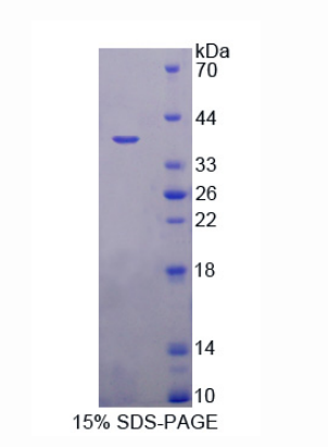 永离有丝分裂基因A相关激酶2(NEK2)重组蛋白