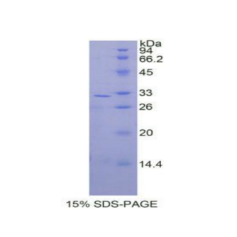 丝裂原激活蛋白激酶激酶3(MAP2K3)重组蛋白