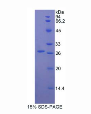 Ig和ITIM域蛋白T-细胞免疫受体(TIGIT)重组蛋白
