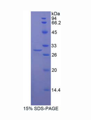 Mindbomb同源物2(MIB2)重组蛋白