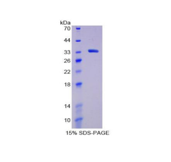 淋巴细胞激活基因3(LAG3)重组蛋白