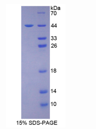 CD2关联蛋白(CD2AP)重组蛋白
