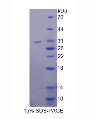 磷酸肌醇-3-激酶衔接蛋白1(PIK3AP1)重组蛋白