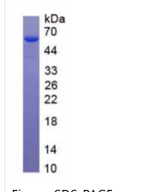 连接附着分子3(JAM3)重组蛋白