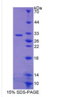 EGF样域蛋白7(EGFL7)重组蛋白