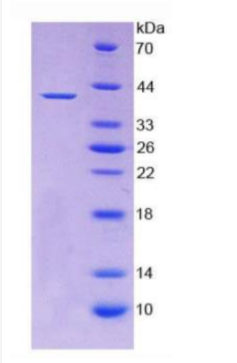 无翅型MMTV整合位点家族成员2(WNT2)重组蛋白