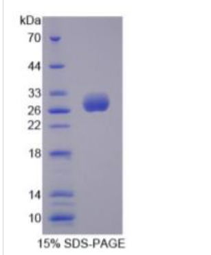 UL16结合蛋白2(ULBP2)重组蛋白