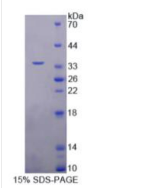 Nei内切核酸酶Ⅷ样蛋白1(NEIL1)重组蛋白