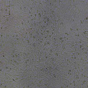 A2058（人皮肤癌细胞）