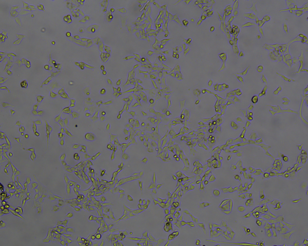 RD细胞|RD人恶性胚胎横纹肌瘤细胞