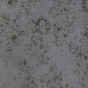 C33A细胞|C33A人宫颈癌细胞