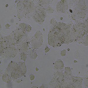 T84细胞|T84人结肠腺癌肺转移细胞