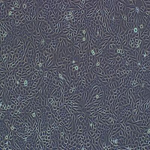 NCI-H647细胞|NCI-H647人肺癌细胞