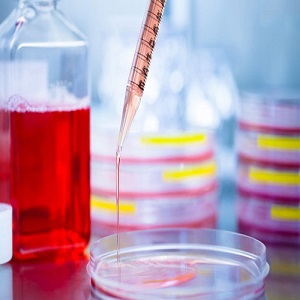 OS-RC-2细胞|OS-RC-2人肾癌细胞