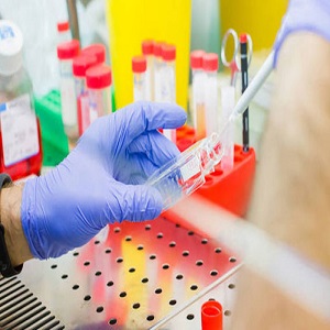 NCI-H226细胞|NCI-H226人肺鳞癌细胞