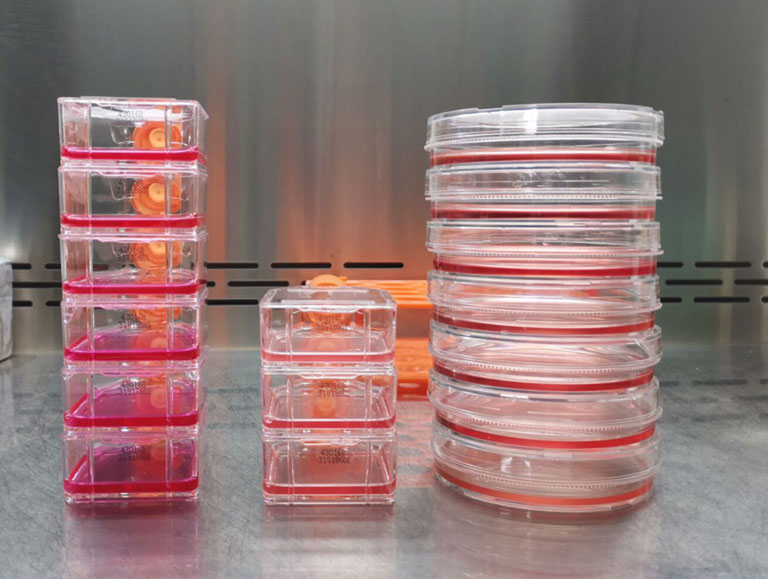 SW-13细胞|SW-13人肾上腺皮质小细胞癌细胞