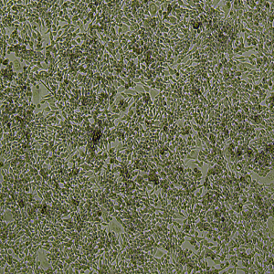 LA795细胞|LA795小鼠肺腺癌细胞