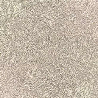 人脐带间充质干细胞