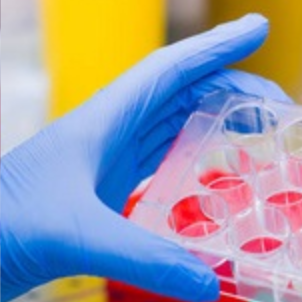 4-羟基甲苯磺丁脲（CYP2C9）