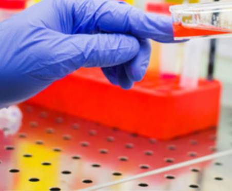 睾酮/睾丸酮 Testosterone（CYP3A4）