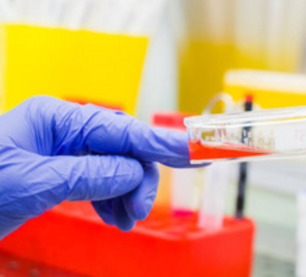 美芬妥因S-Mephenytoin（CYP2C19）