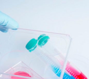 红细胞分离试剂盒 红细胞分离液