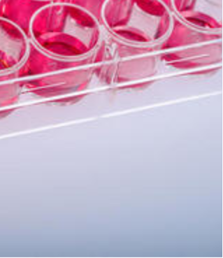 大鼠PBMC分离试剂盒 大鼠PBMC分离液