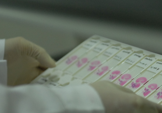 CYP2A6（CYP450重组酶）