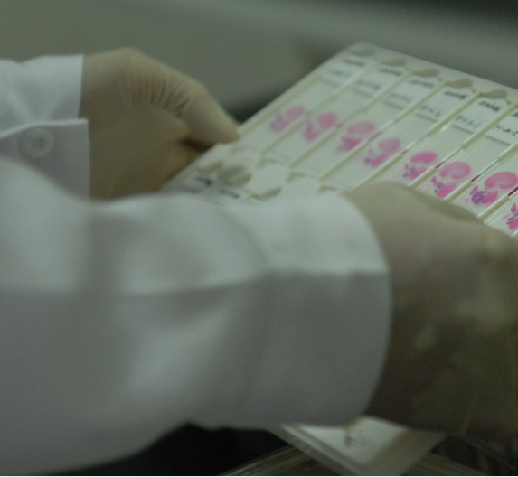 CYP1A1（CYP450重组酶）