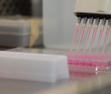 SD大鼠肾微粒体 Rat Kidney Microsomes