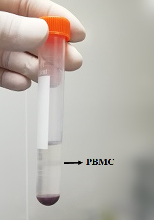 猴肝微粒体 Monkey Liver Microsomes