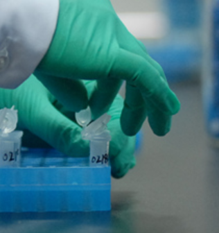 NADPH Regeneration System