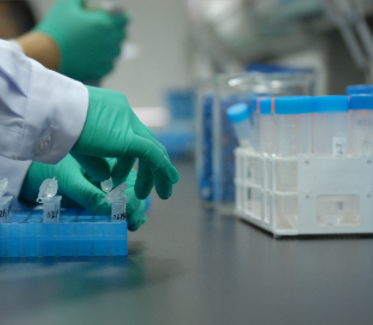 CYP46A1（CYP450重组酶）