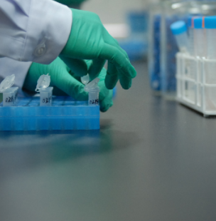 Human UGT1A9重组酶