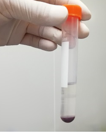 金黄地鼠血浆 Hamster Plasma