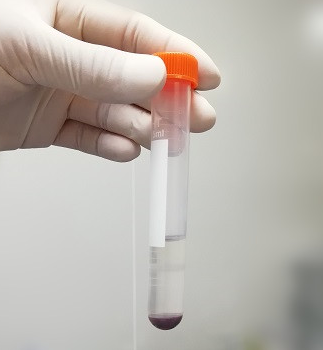 金黄地鼠血清 Hamster Serum