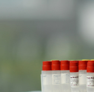 单克隆抗体制备