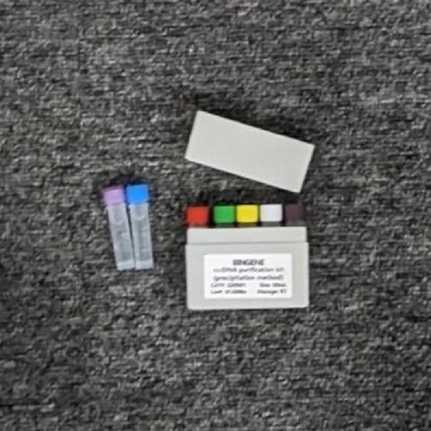 RNA样品残留基因组DNA清除剂（双链DNA专一性DNase）