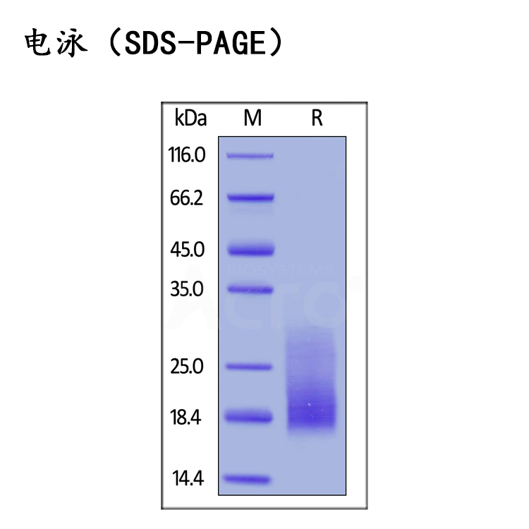 重组人TIGIT靶点蛋白，T细胞免疫球蛋白ITIM结构域