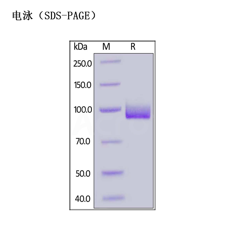 百普赛斯PSMA蛋白厂家，重组人PSMA蛋白