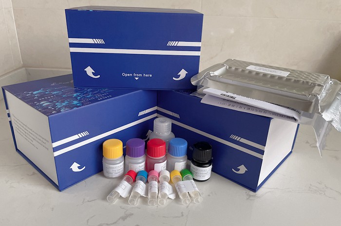 Human Hepatitis D Virus IgM (HDV) ELISA Kit