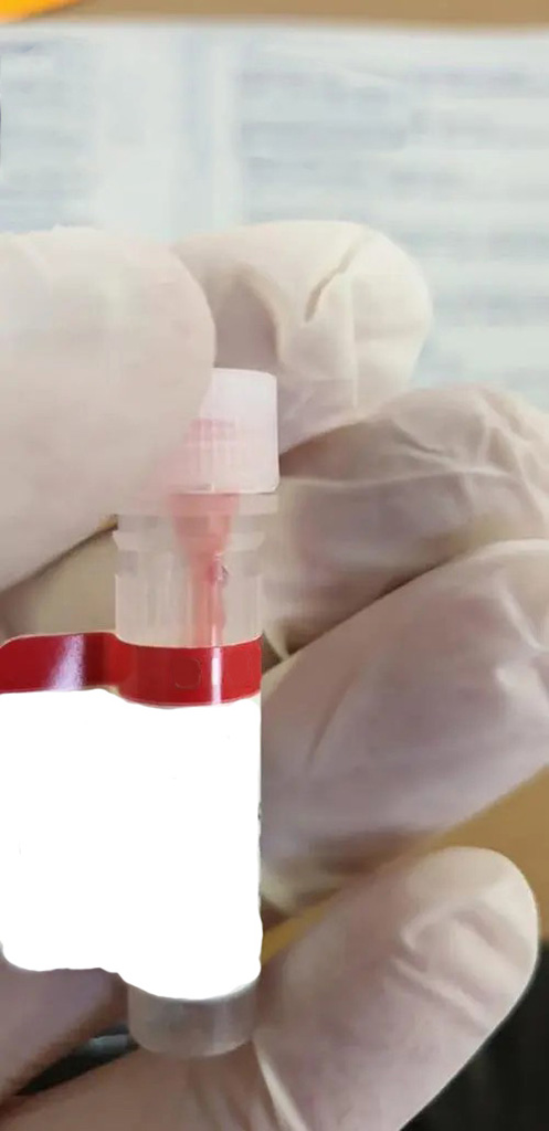 IGHG1（人源）IP-WB抗体对