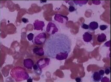 AAV-293（人胚肾细胞） (STR鉴定正确)